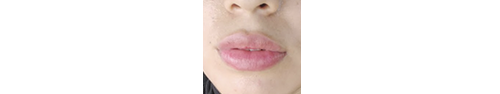 fer_verdesoto_valeria mg_microlips.png